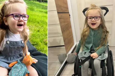 Uśmiechnięta dziewczynka w okularach, z długimi blond włosami. Na jednym zdjęciu siedzi na trawie z zabawką, na drugim w wózku inwalidzkim. Zespół Retta objawy nie definiują jej radości życia.