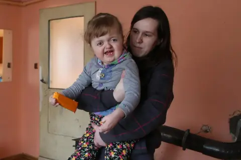 Matka trzyma dziecko z zespołem Aperta. Dziewczynka ma pomarańczową zabawkę.