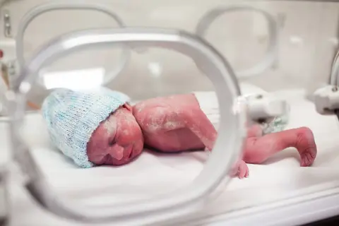 Malutkie dziecko urodzone w 20 tygodniu ciąży, w niebieskiej czapeczce, leży w inkubatorze.
