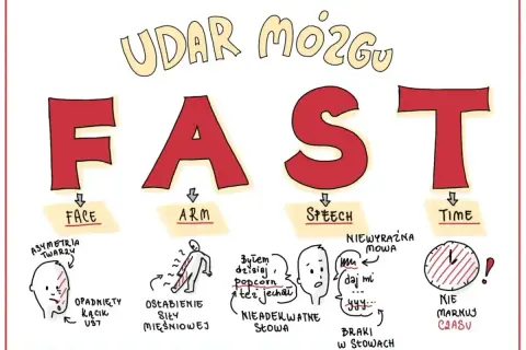 Udar mózgu u dzieci: FAST - twarz, ręka, mowa, czas. Objawy: opadnięty kącik ust, osłabienie siły mięśniowej, nieadekwatne słowa, braki w mowie, brak reakcji na czas.