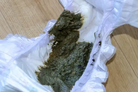 Zielona kupa w pieluszce, która wymaga zmiany.