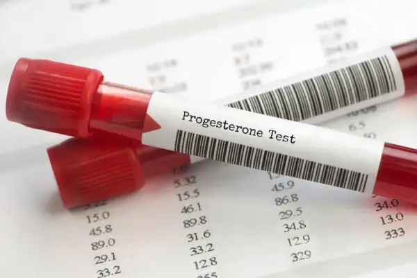 Dwie probówki z krwią oznaczone "Progesterone Test" leżą na papierze z wynikami badań. Kluczowe dla monitorowania progesteronu w ciąży.